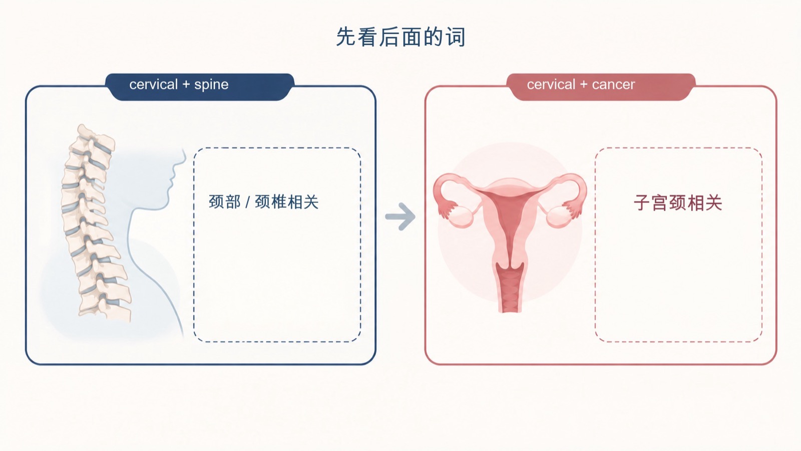 cervical 通过后接 spine 或 cancer 分别判断为颈椎相关和子宫颈相关的搭配判断图。